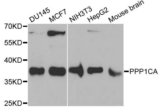 Western blot - PPP1CA Polyclonal Antibody (144-12468)