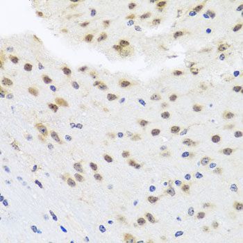 Immunohistochemistry - HDAC4 Polyclonal Antibody (144-00179)