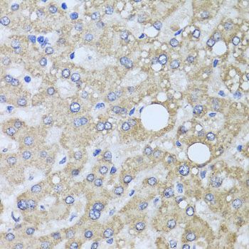 Immunohistochemistry - AARS2 antibody (144-07826)
