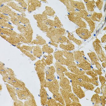 Immunohistochemistry - SYK Antibody (144-02123)
