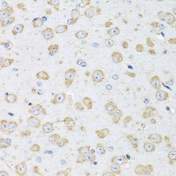 Immunohistochemistry - ALB Polyclonal Antibody (144-00353)