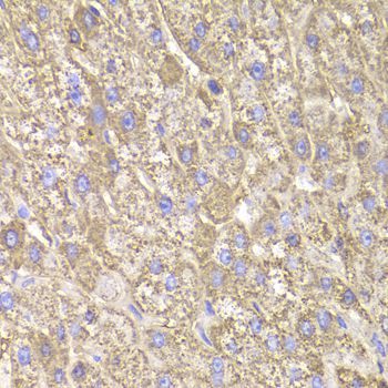 Immunohistochemistry - CIAPIN1 Polyclonal Antibody (144-06336)