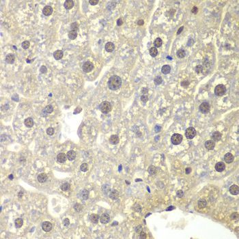 Immunohistochemistry - NR3C1 antibody (144-02164)