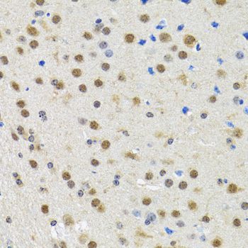 Immunohistochemistry - SPIN1 antibody (144-05853)
