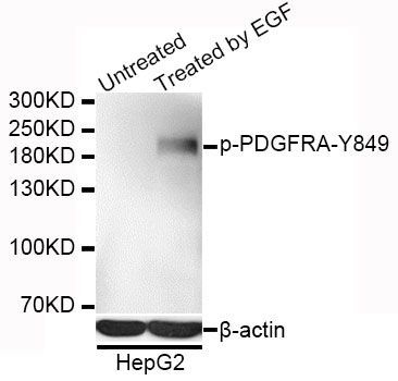 Western blot - Phospho-PDGFRA-Y849 antibody (144-50569)