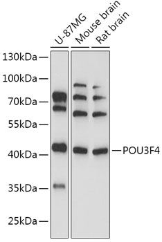 Western blot