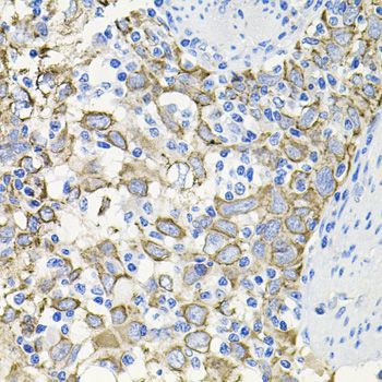 Immunohistochemistry - ACVR2A Polyclonal Antibody (144-01981)