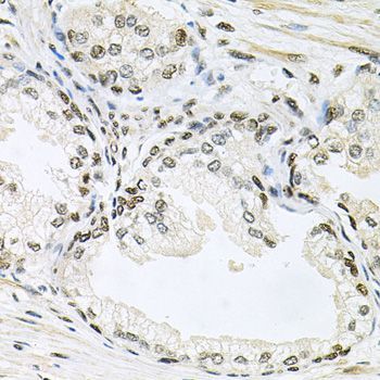 Immunohistochemistry - MAPK8 Polyclonal Antibody (144-00288)