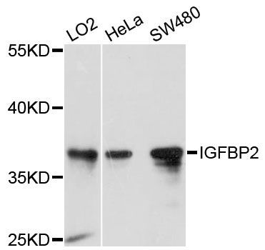 Western blot - IGFBP2 Polyclonal Antibody (144-00403)