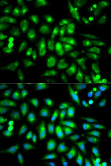 Immunofluorescence - CHRM2 antibody (144-01567)