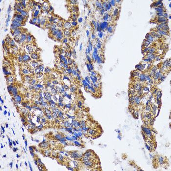 Immunohistochemistry - TP53 Polyclonal Antibody (144-05761)
