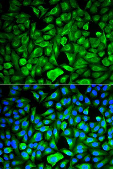 Western blot - PEBP1 Polyclonal Antibody (144-00578)