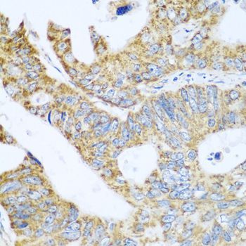 Immunohistochemistry - GLUD1 antibody (144-07631)