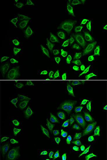 Immunofluorescence - PLA2G2D antibody (144-07165)