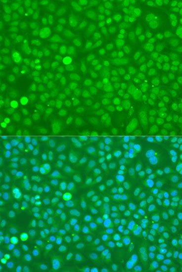 Immunofluorescence - UBC antibody (144-03207)