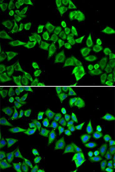 Immunofluorescence - DDX20 antibody (144-05817)