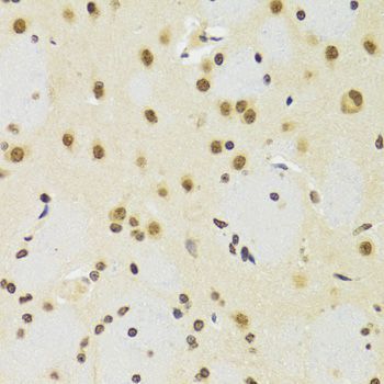 Immunohistochemistry - [KO Validated] SUZ12 Polyclonal Antibody (144-07786)