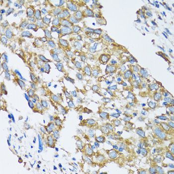 Immunohistochemistry - SLC25A13 Polyclonal Antibody (144-012557)