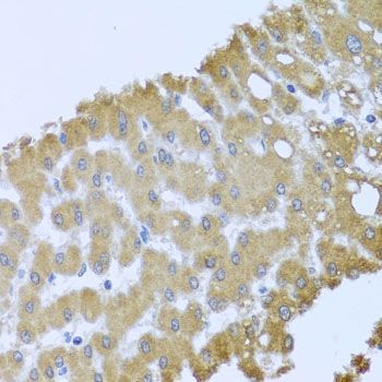 Immunohistochemistry - ACP1 antibody (144-012390)