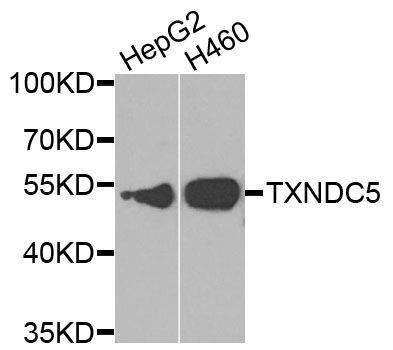 Western blot - TXNDC5 antibody (144-014152)