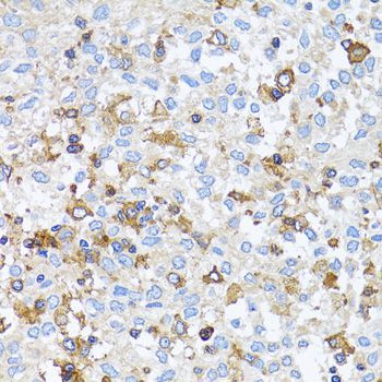 Immunohistochemistry - ACTR2 Polyclonal Antibody (144-05734)