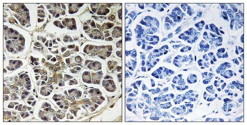 IHC