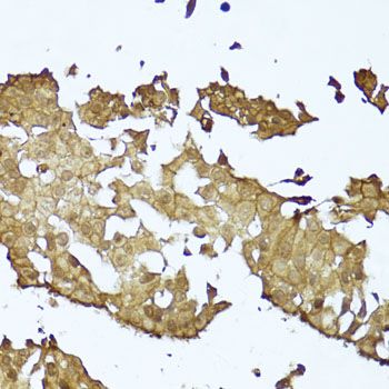 Immunohistochemistry - CTNNB1 Polyclonal Antibody (144-011512)