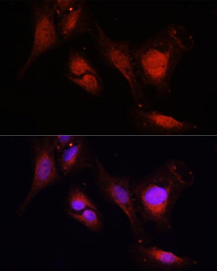 Immunofluorescence - MMP2 antibody (144-06247)