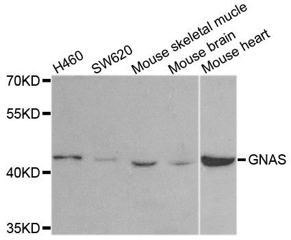 Western blot - GNAS antibody (144-02732)