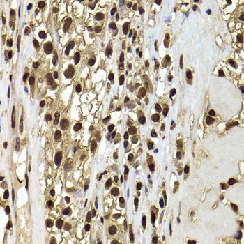 Immunohistochemistry - ACTL6B Polyclonal Antibody (144-07108)