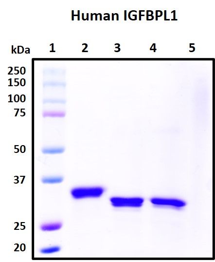SDS-PAGE