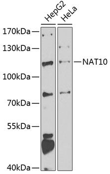 Western blot