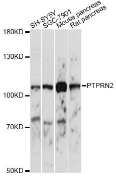 Western blot - PTPRN2 antibody (144-60786)