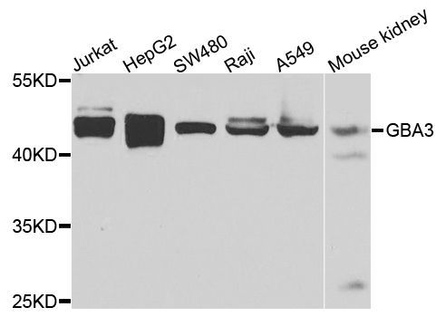 Western blot - GBA3 antibody (144-07827)
