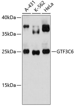 Western blot