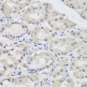 Immunohistochemistry - AGO2 antibody (144-06802)