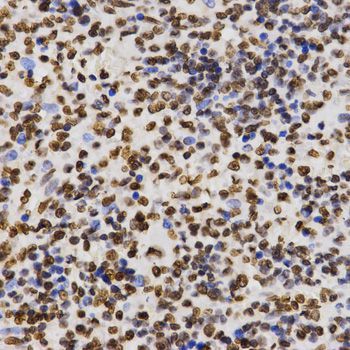 Immunohistochemistry - DiMethyl-Histone H3-K27 pAb (144-02362)