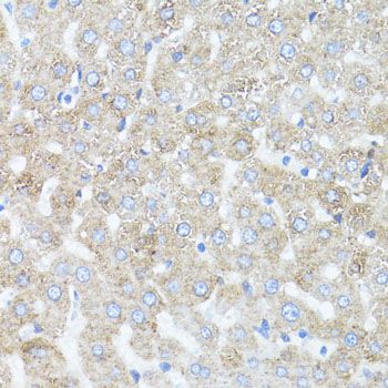 Immunohistochemistry - ARRB1 Polyclonal Antibody (144-00998)