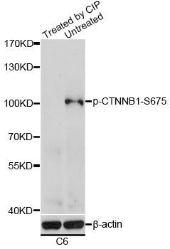 Western blot - Phospho-CTNNB1-S675 antibody (144-61524)