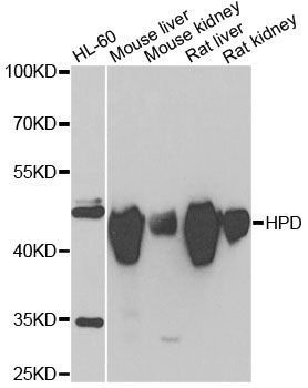 Western blot - HPD antibody (144-06505)