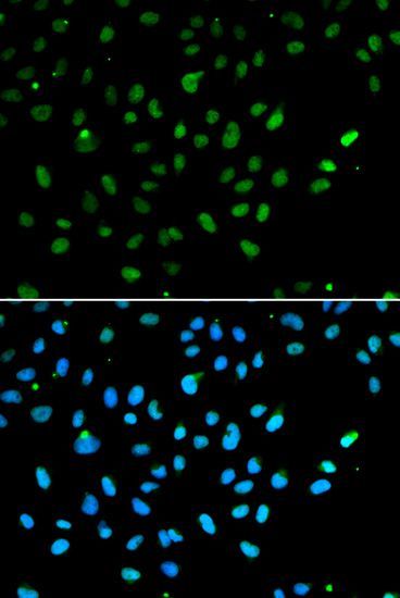 Immunofluorescence - SMARCA4 antibody (144-02117)