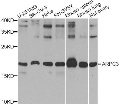 Western blot - ARPC3 Antibody (144-07767)