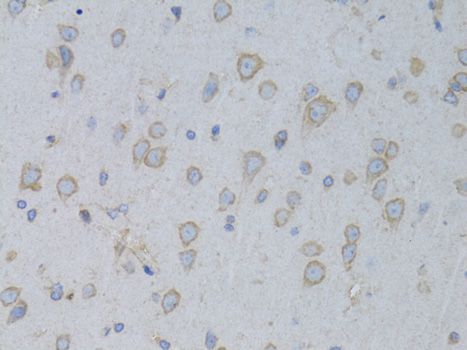 Immunohistochemistry - GARS Polyclonal Antibody (144-05435)