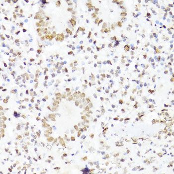 Immunohistochemistry - Phospho-Stat3-Y705 pAb (144-50070)