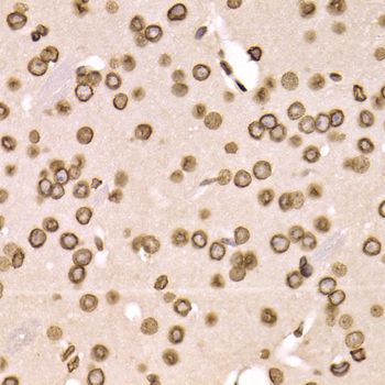 Immunohistochemistry - LMNB2 Polyclonal Antibody (144-06483)