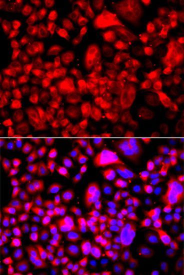Immunofluorescence - FASN Polyclonal Antibody (144-00461)