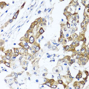 Immunohistochemistry - PPOX Polyclonal Antibody (144-06397)