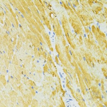 Immunohistochemistry - SIRT2 antibody (144-12575)