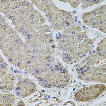 Immunohistochemistry - PLK4 antibody (144-09863)