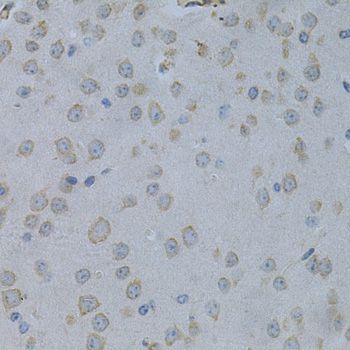 Immunohistochemistry - STMN1 Polyclonal Antibody (144-014018)